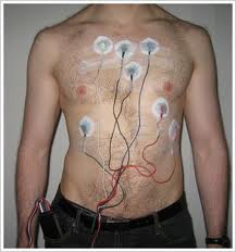 Holter Monitor