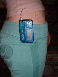 Insulin Pump